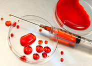 Test krwi pozwalający diagnozować zespół przewlekłego zmęczenia